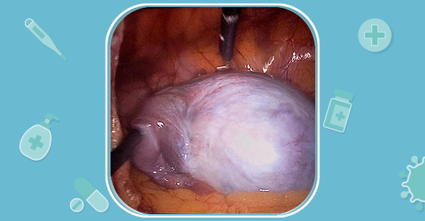 surgery-1